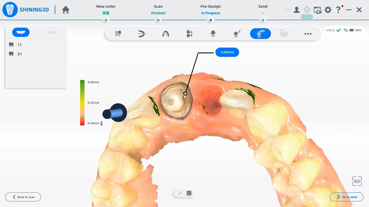 aoralscan-3-wireless — Review the scan before sending the case