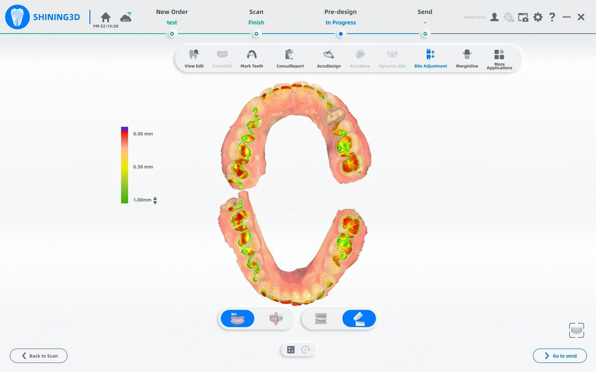 aoralscan-3 — Review the scan before sending the case