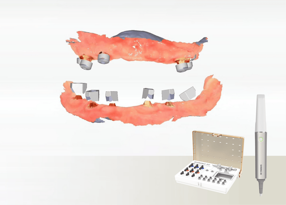 Aoralscan Elite — Photogrammetry for All-on-X (official manufacturer visual)