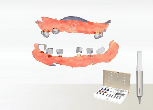 Aoralscan Elite — Photogrammetry for All-on-X (official manufacturer visual)