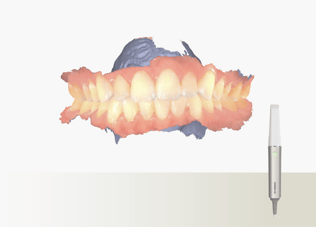 Aoralscan Elite — Everyday intraoral scanning (official manufacturer visual)