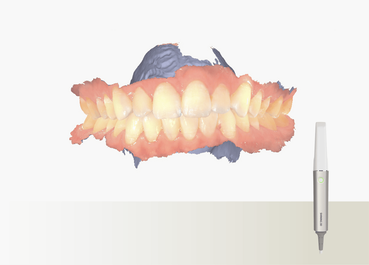 Aoralscan Elite — Everyday intraoral scanning (official manufacturer visual)