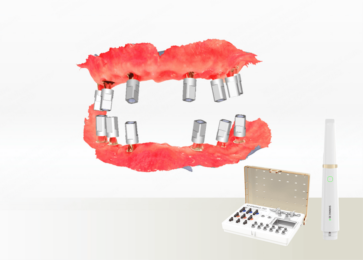 Aoralscan Elite Wireless — Photogrammetry for All-on-X (official manufacturer visual)