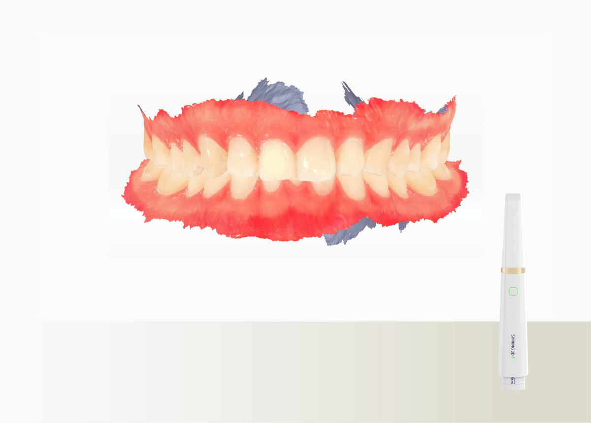 Aoralscan Elite Wireless — Everyday intraoral scanning (official manufacturer visual)