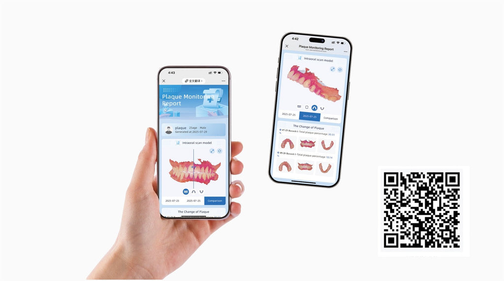 Aoralscan Elf — Share the findings (official manufacturer visual)