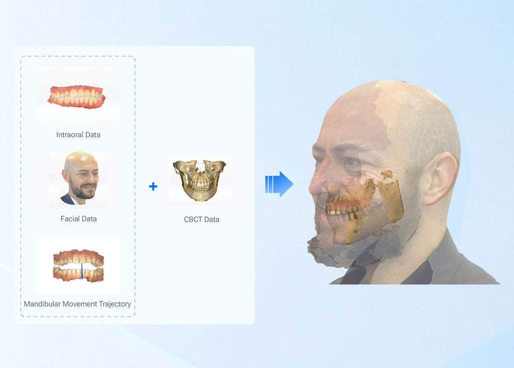 MetiSmile-MR — Connect facial and dental data (official manufacturer visual)