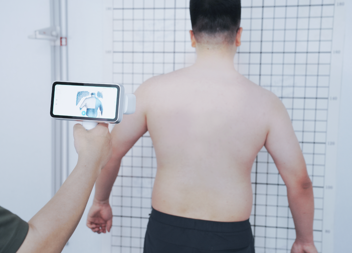 تعويض الحركة الطفيفة